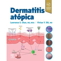 Dermatitis Atópica