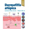Dermatitis Atópica
