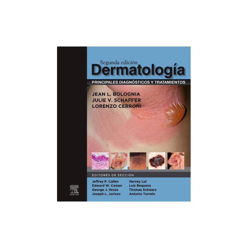 Dermatología: principales diagnósticos y tratamientos