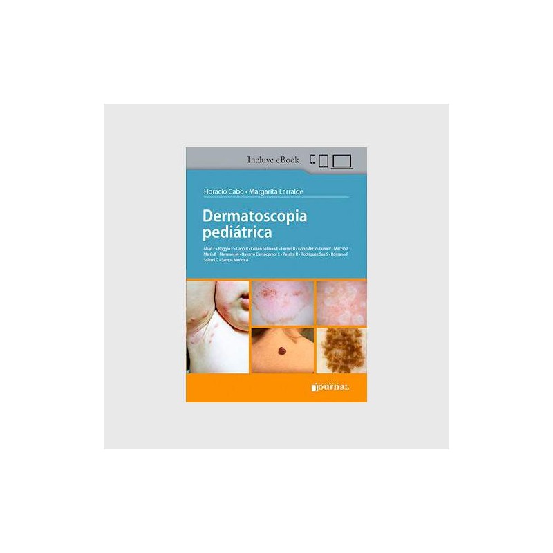 DERMATOSCOPIA PEDIATRICA