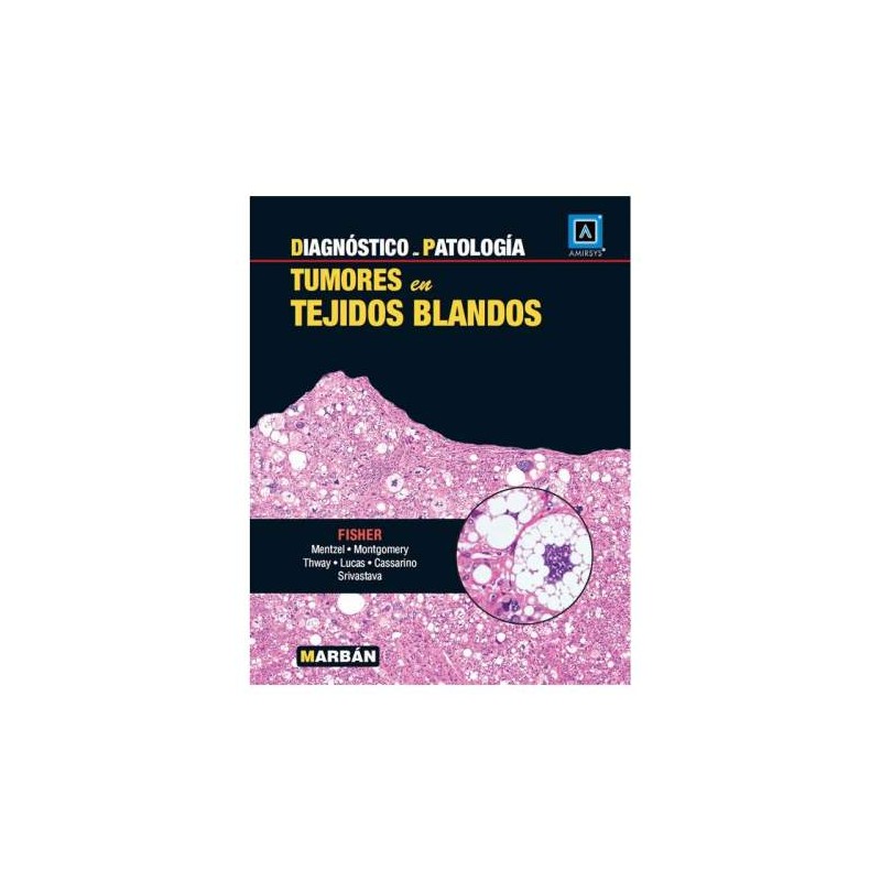 DIAGNOSTICO EN PATOLOGIA -TUMORES EN TEJIDOS BLANDOS-