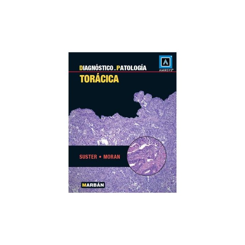 DIAGNOSTICO EN PATOLOGIA TORACICA