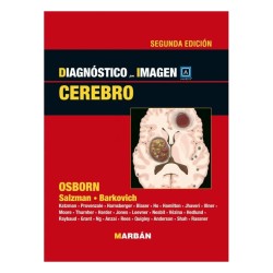 DIAGNOSTICO POR IMAGEN CEREBRO AMIRSYS"(ROJO)"