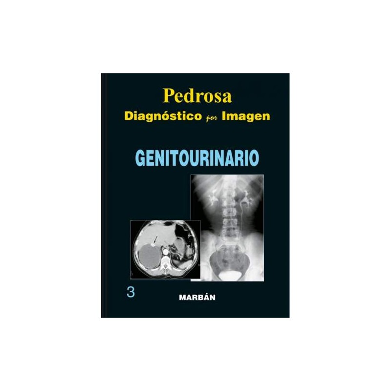 DIAGNOSTICO POR IMAGEN GENITOURINARIO -GRAN FORMATO-