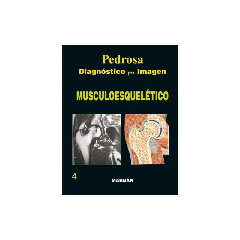 DIAGNOSTICO POR IMAGEN MUSCULOESQUELETICO FLEXILIBRO 21