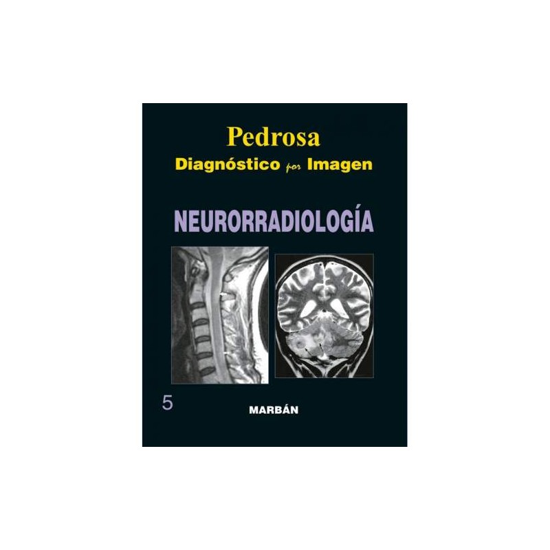 DIAGNOSTICO POR IMAGEN NEURORRADIOLOGIA GRAN FORMATO