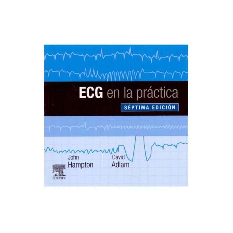 ECG en la práctica