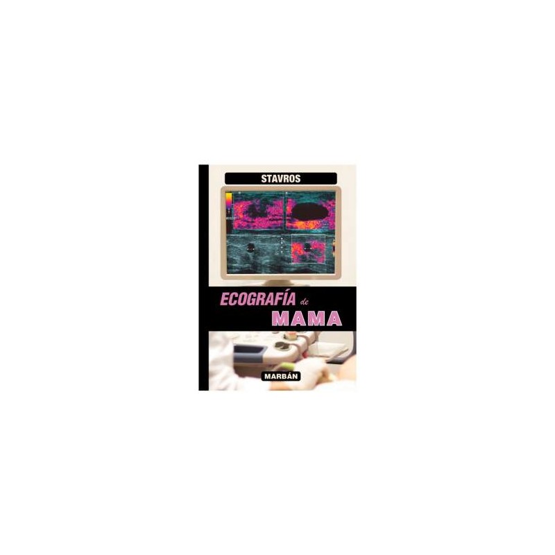 ECOGRAFIA DE MAMA