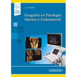 Ecografía en Patología Uterina y Endometrial