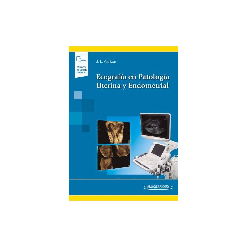 Ecografía en Patología Uterina y Endometrial