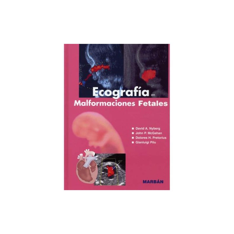 ECOGRAFIA MALFORMACIONES FETALES (FLEXILIBRO 19)