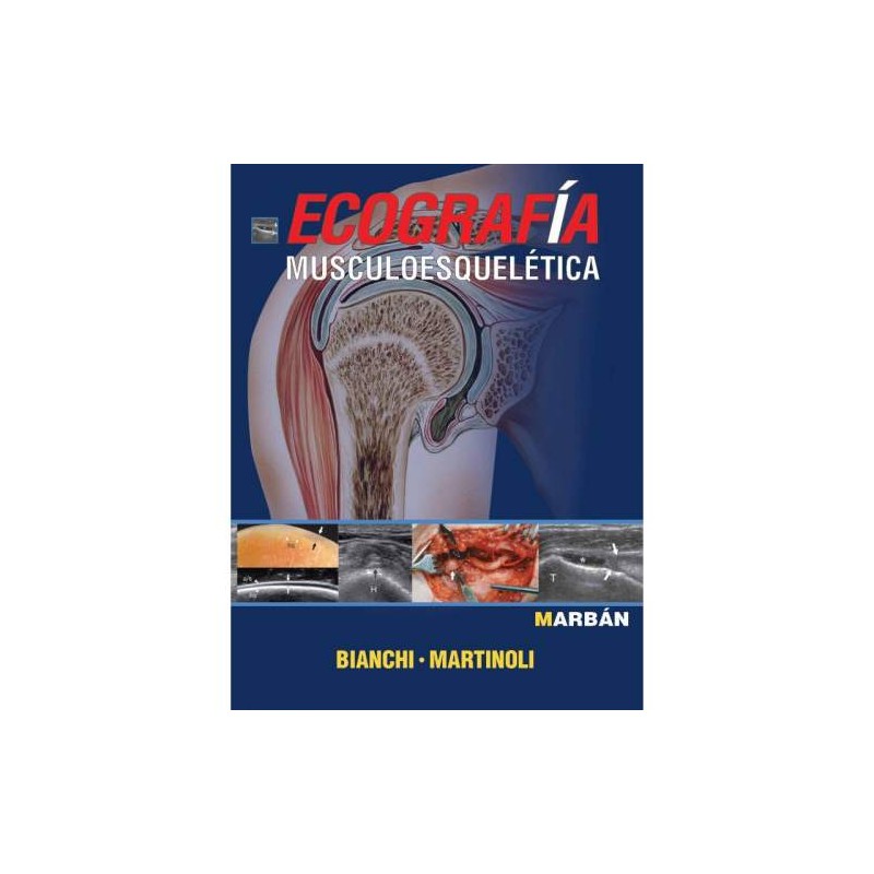 ECOGRAFIA MUSCULOESQUELETICA