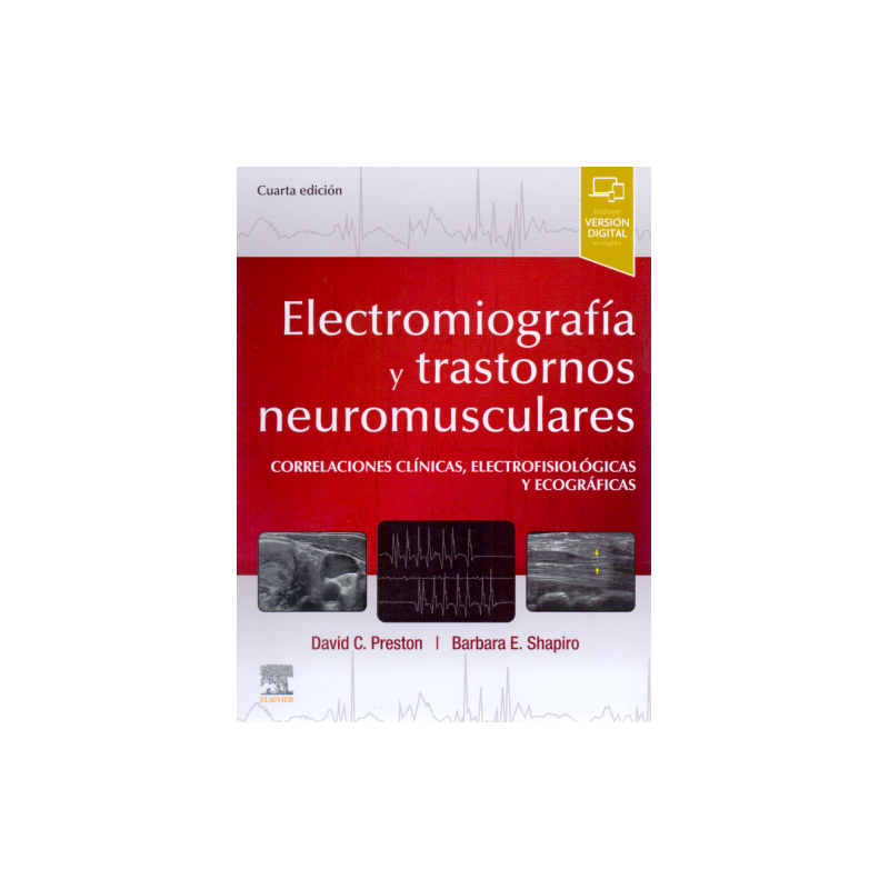 Electromiografía y trastornos neuromusculares
