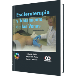 Escleroterapia y Tratamiento de las venas,