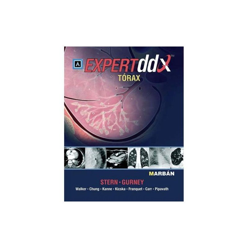 EXPERTDDX TORAX AMIRSYS"(AZUL)"