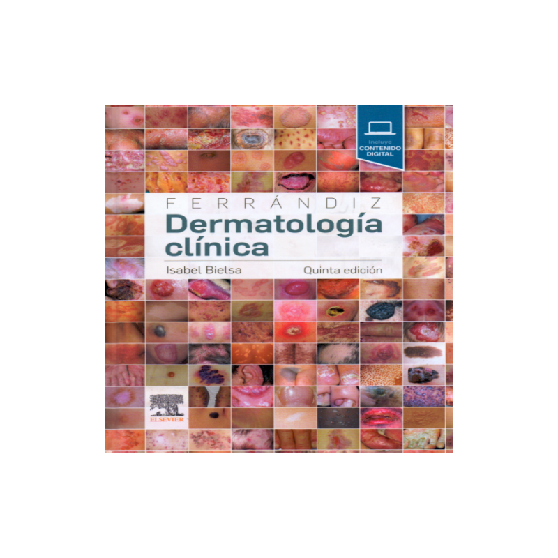 Ferrándiz Dermatología clínica 5 ed