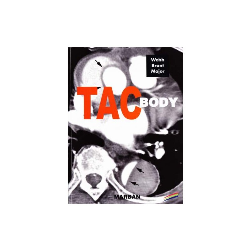 FUNDAMENTOS DE TAC BODY -RESIDENTE 15-