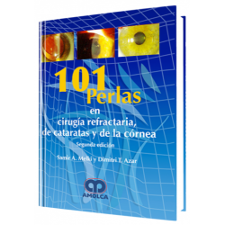 101 Perlas en Cirugía Refractaria de Catarátas y Cornea