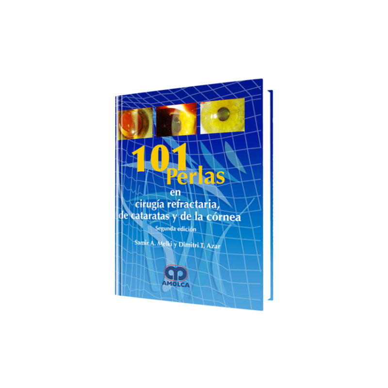 101 Perlas en Cirugía Refractaria de Catarátas y Cornea