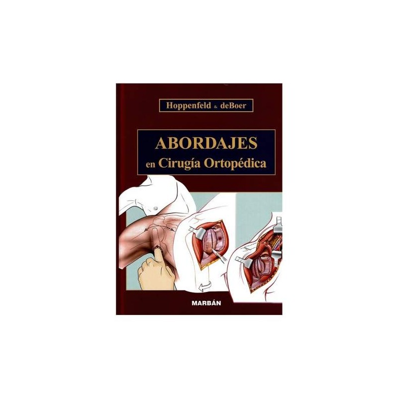 ABORDAJES EN CIRUGIA ORTOPEDICA