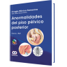 Anormalidades del Piso Pélvico Posterior