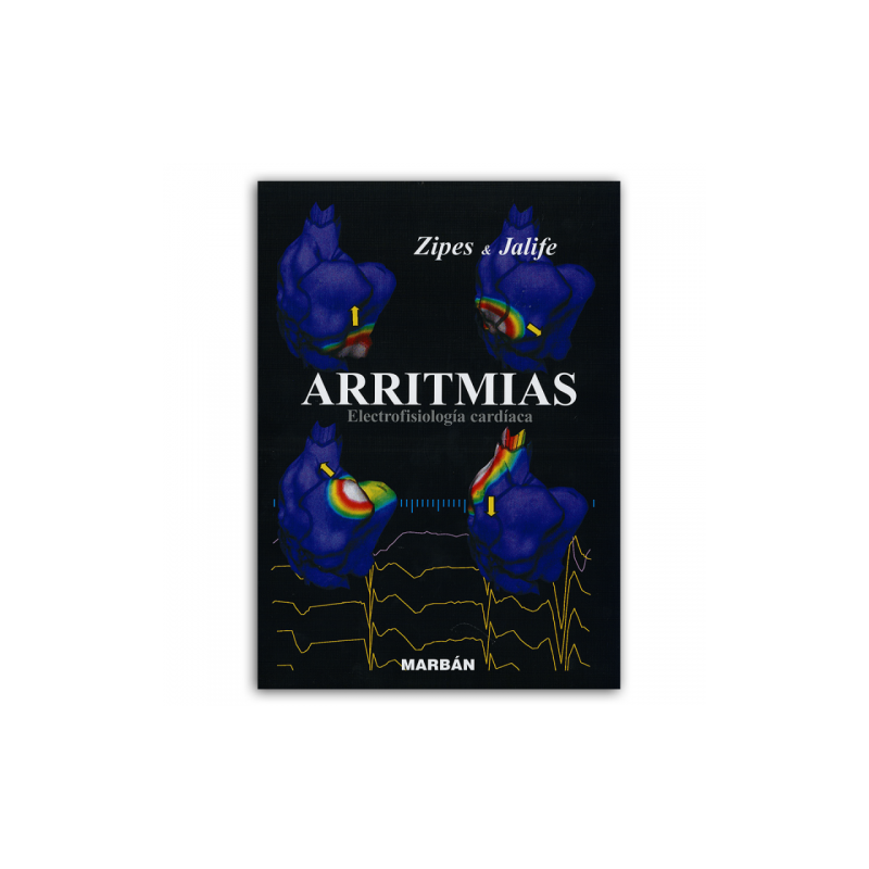 ARRITMIAS