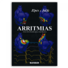 ARRITMIAS