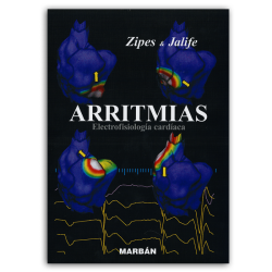 ARRITMIAS