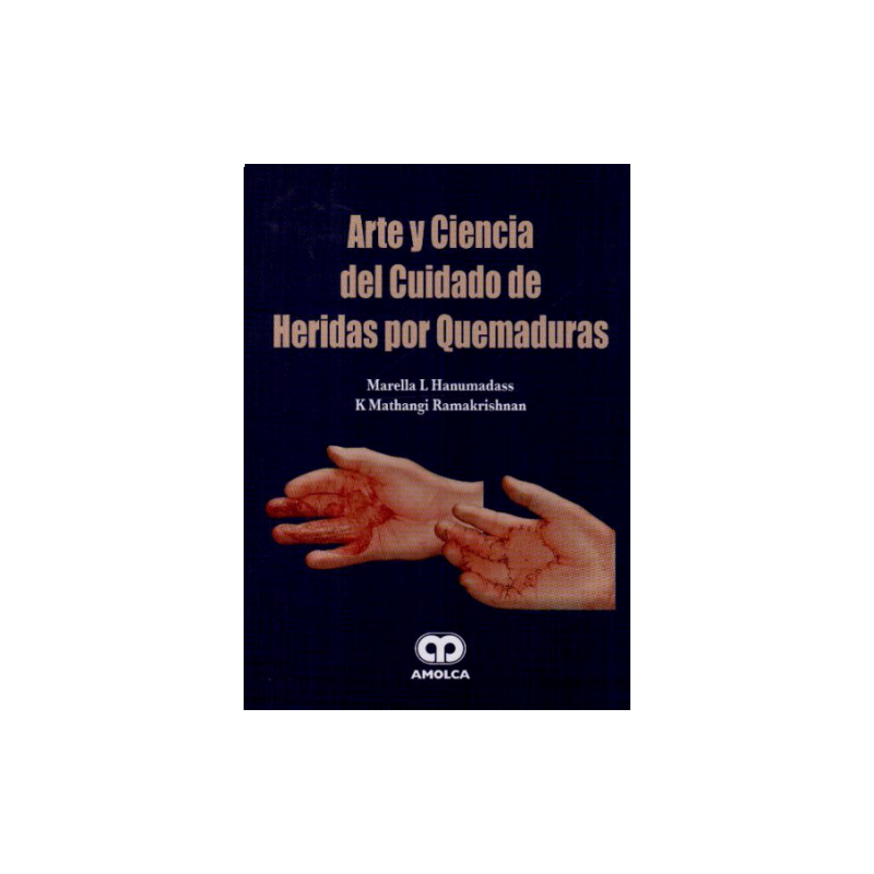 Arte y Ciencia del Cuidado de Heridas por Quemaduras