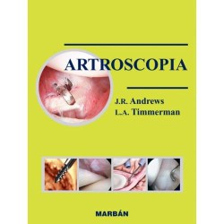 ARTROSCOPIA