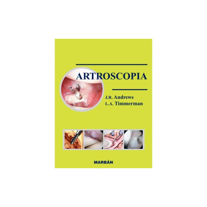 ARTROSCOPIA