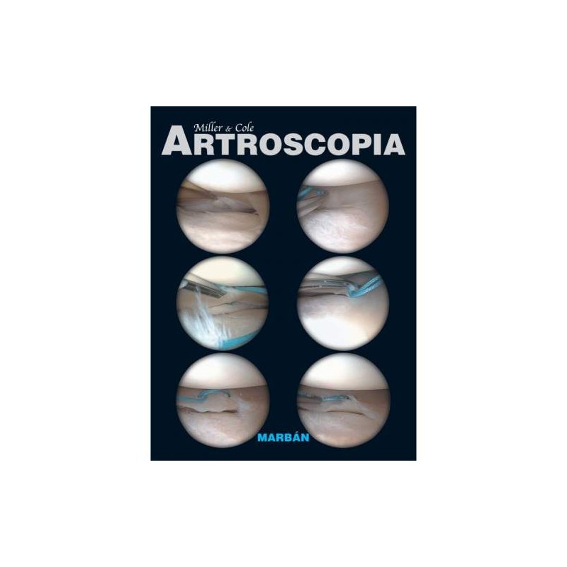 ARTROSCOPIA -FLEXILIBRO-