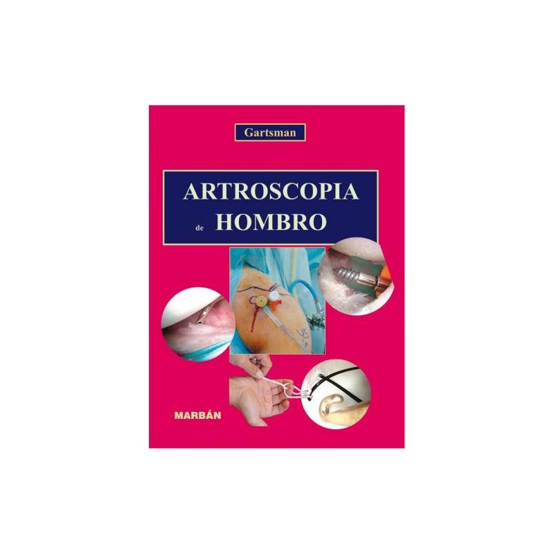 ARTROSCOPIA DEL HOMBRO