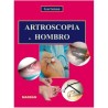 ARTROSCOPIA DEL HOMBRO