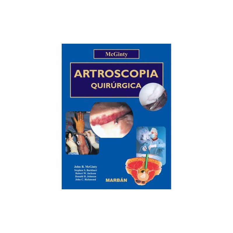 ARTROSCOPIA QUIRURGICA