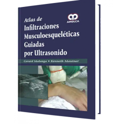 Atlas de Infiltraciones Muscoloesqueléticas Guiadas por Ults.