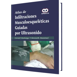 Atlas de Infiltraciones Muscoloesqueléticas Guiadas por Ults.