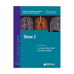 AVANCES DIAGNOSTICO IMAGENES TORAX 2