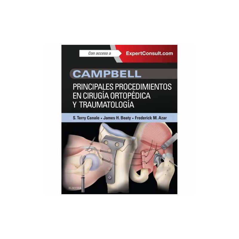 Campbell. Principales procedimientos en cirugía ortopédica y traumatología
