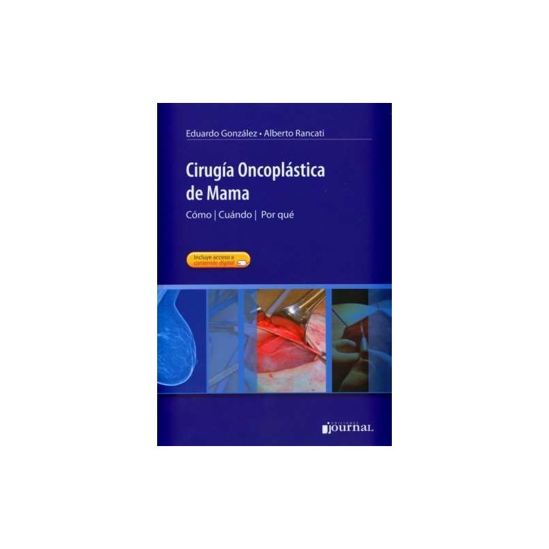 CIRUGIA ONCOPLASTICA MAMA 2013