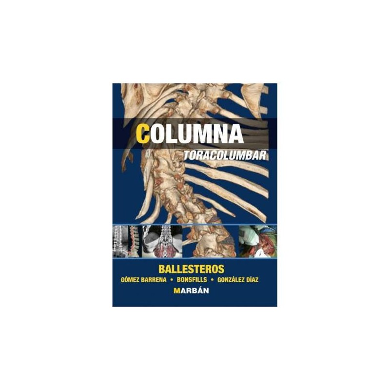 COLUMNA TORACOLUMBAR